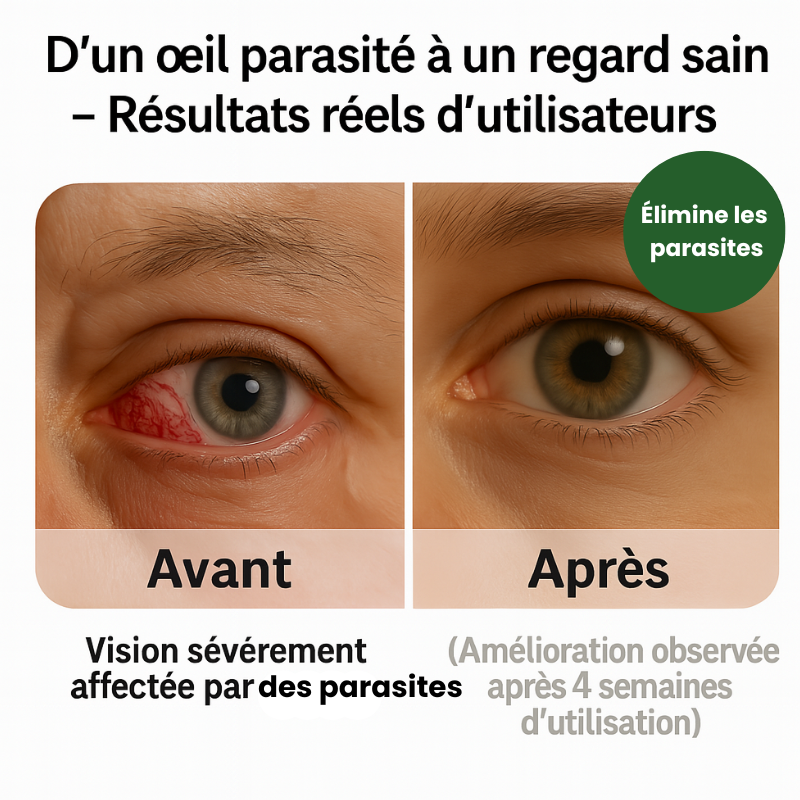 Nutrivue – Vitamines oculaires à base de lutéine